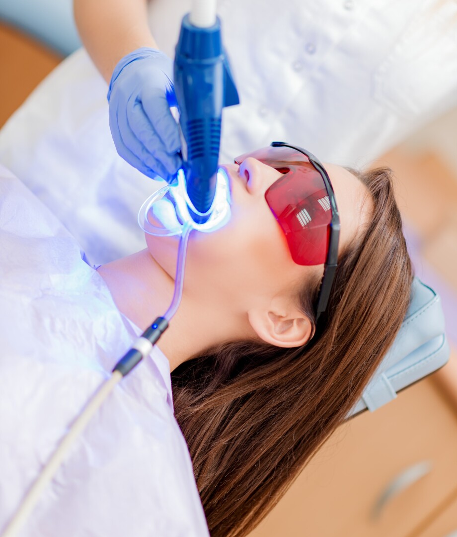 Blanqueamiento Dental